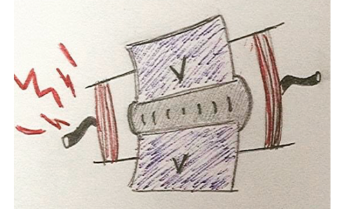 Alterazione del Sistema Nervoso